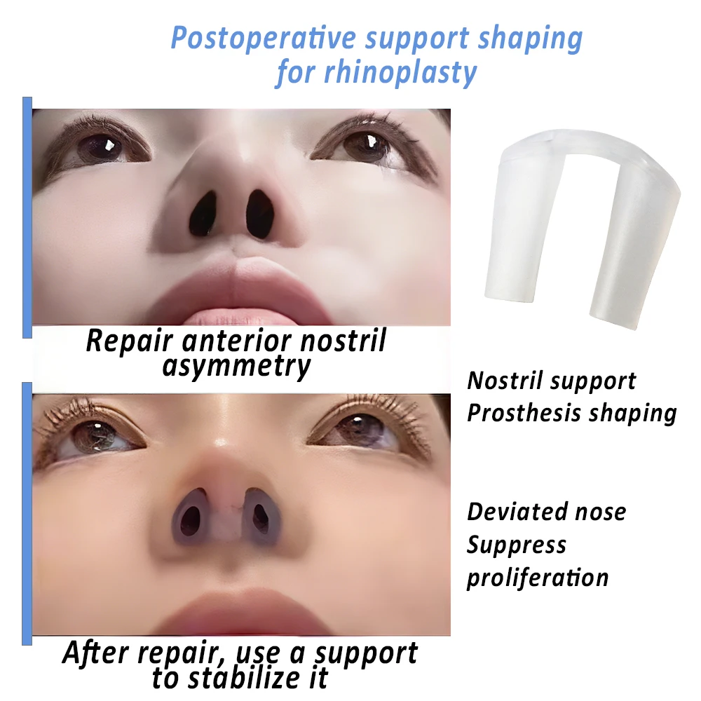 Postoperative Rhinoplasty Nost - Anti Snore Contour Pillow review and price